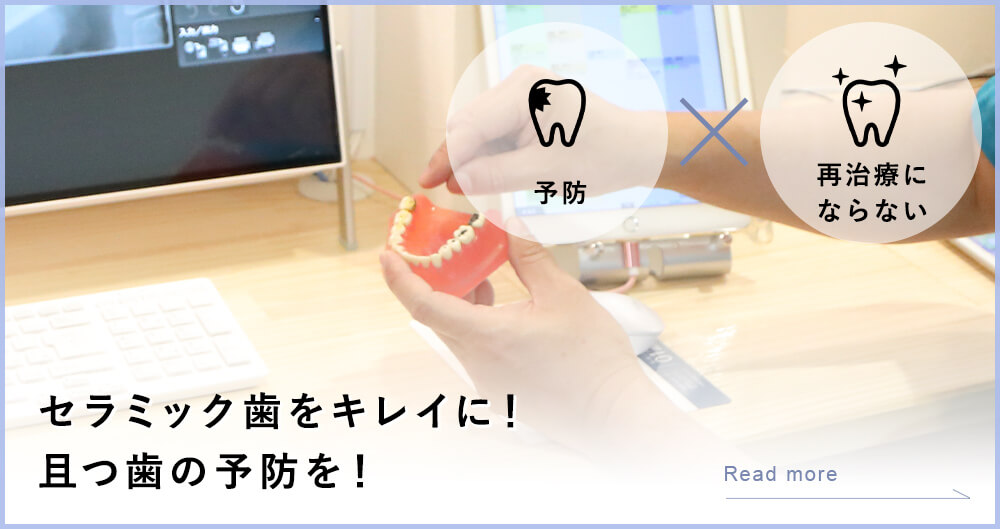 セラミック歯をキレイに！且つ歯の予防を！